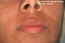 lip-na2.jpg